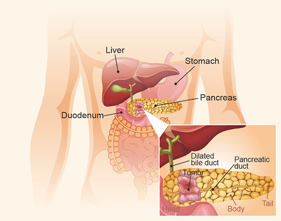 胰腺結構示意圖